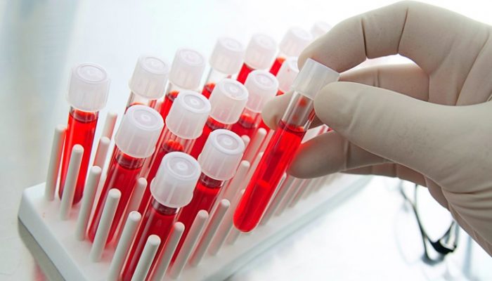Exceso de glóbulos rojos en la sangre: Síntomas y causas