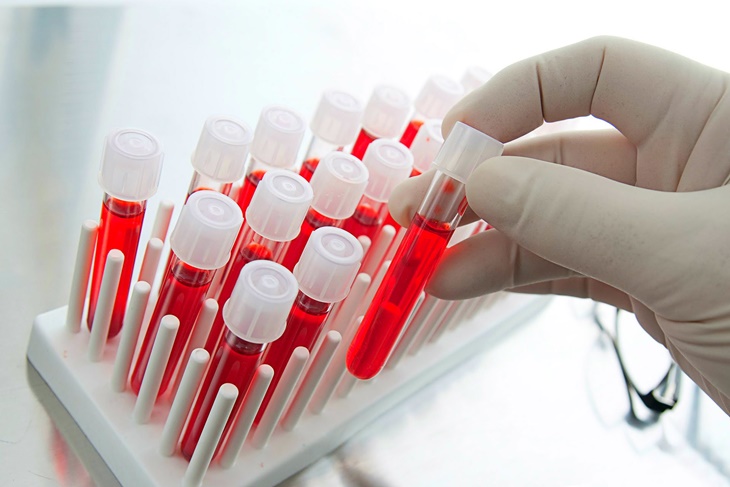 Exceso de glóbulos rojos en la sangre: Síntomas y causas
