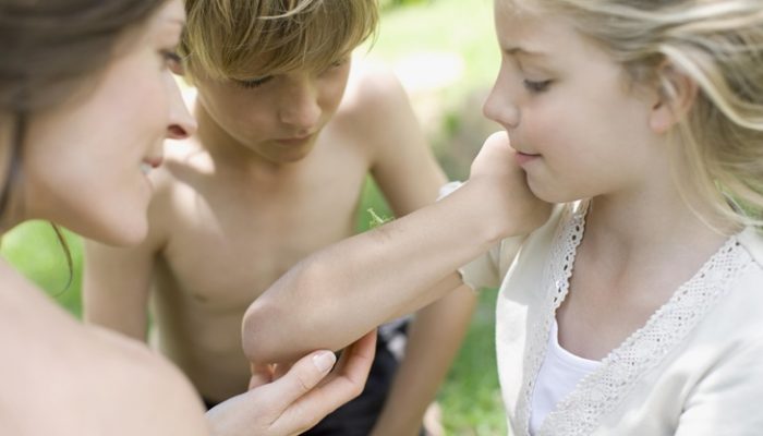 Picaduras de mosquitos: Reacciones alérgicas y remedios