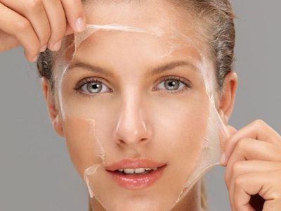 Peeling químico facial: En qué consiste