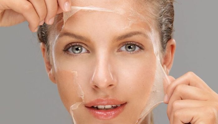 Peeling químico facial: En qué consiste