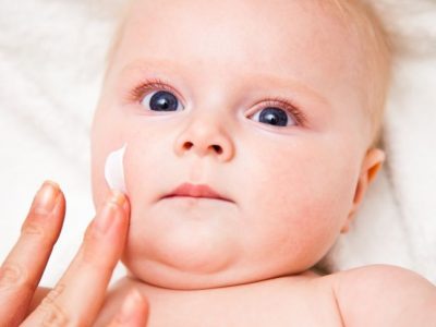 Dermatitis atópica en niños: Cuidados adecuados y consejos