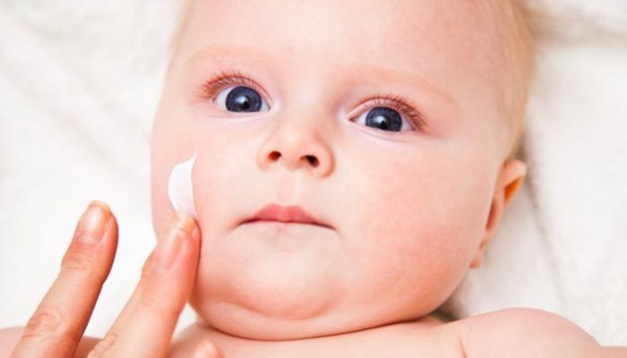 Dermatitis atópica en niños: Cuidados adecuados y consejos