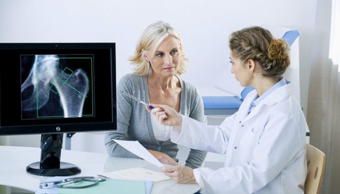 Día Mundial de la Osteoporosis 2016: Cuida tus huesos
