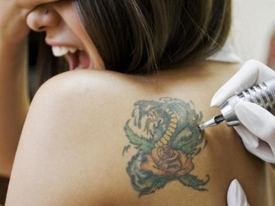 Eliminar tatuajes con láser: Precio y eficacia