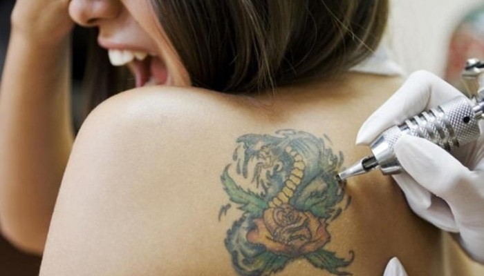 Eliminar tatuajes con láser: Precio y eficacia