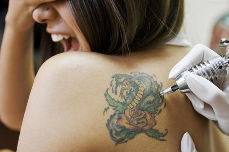 Eliminar tatuajes con láser: Precio y eficacia