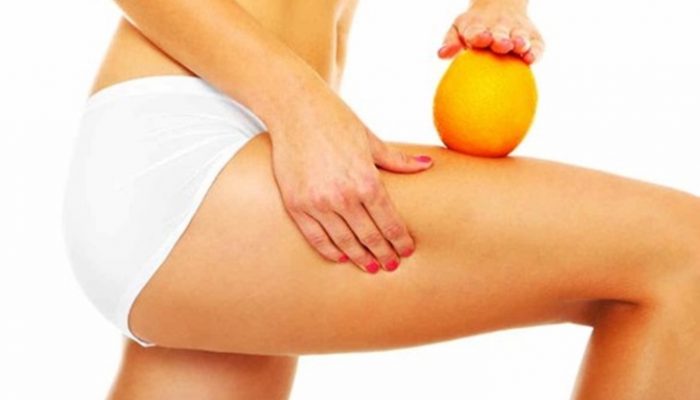 Alimentos que previenen la celulitis