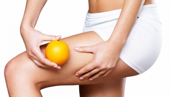 Celulitis: Malos hábitos que motivan su aparición