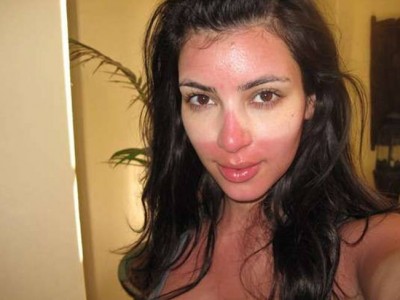 Famosos quemados bajo el sol: Las quemaduras de las celebs