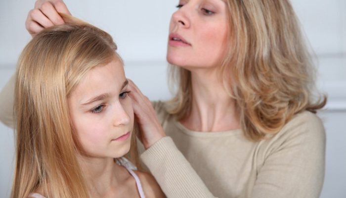 Las 6 dudas más comunes de los padres cuando su hijo tiene piojos